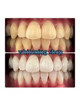 ホワイトニングショップ 所沢店/ホワイトニングショップ所沢店