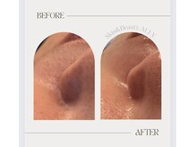 アリー(ALLY)/艶肌wax