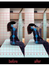 よし鍼灸接骨院 南堀江院/