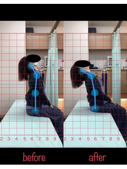 よし鍼灸接骨院 南堀江院/