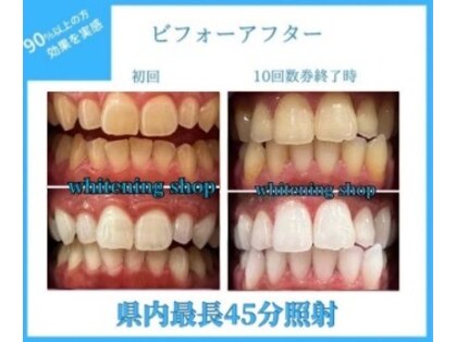 ホワイトニングショップ 豊田店(WHITENING SHOP)の写真