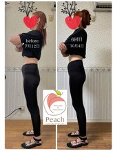 ピーチ鍼灸整体治療院(Peach鍼灸整体治療院)/ヒップアップ/ぽっこりお腹