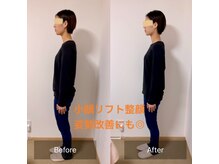 チル(Chill.)/小顔リフト整顔 8