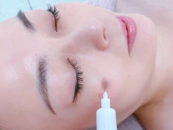 ドゥーソル 谷町四丁目店(due sole)の写真/【エイジングケアに自信◎】ダイエットでは改善しない二重アゴ・フェイスラインのもたつき・たるみを改善＊