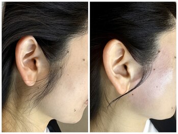 ウパラギンザ(Upala Ginza)/ナチュラルなもみあげ育てます！