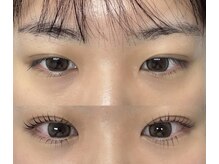 ベストアイラッシュ 渋谷109前店(Best Eyelash)/上下まつ毛パーマ