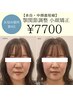 お悩み別★【余白・中顔面短縮】顎関節調整 小顔矯正　￥7700