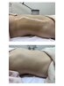 【産後ママ応援☆】痩身ラフォスで体型リセット♪無料相談付き◎
