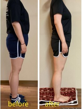 アルマ(ALMA)/20代女性：3ヶ月-7.4kg!