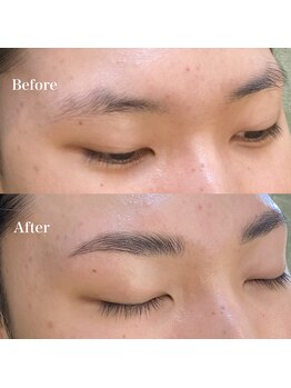 ユマニ バイ ヒート(Humani by HEAT)/メンズハリウッドブロウリフト