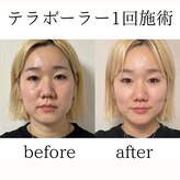 サロン アイミー(salon i me)