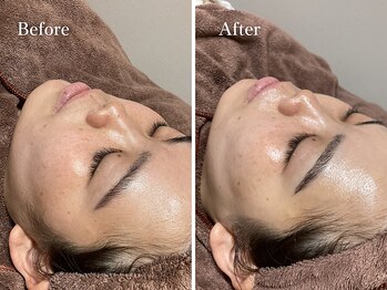 エリー(Ellie)/うるツヤ花嫁肌に♪