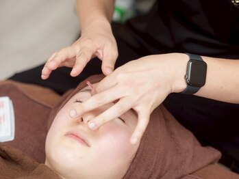 リアライズ(realise)/ ◆美容鍼/毛穴/美白/ニキビケア