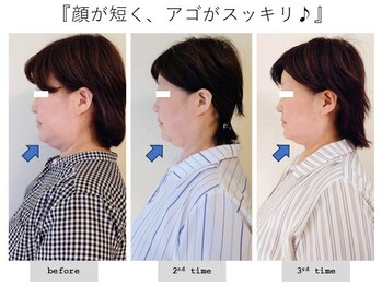 エピファニー(Epiphany)/首肩こりと頭痛が悩みでした…