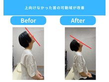 きくち整骨院/1回で首の動きがここまで改善