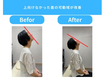 きくち整骨院/1回で首の動きがここまで改善