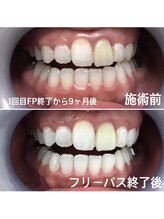 ルブラン 奈良店(Le Blanc)/大事なメンテナンス