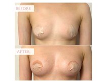 ナナイロ(nanairo)の雰囲気（大分初☆脂肪増殖剤で自身の脂肪を【育てる】のノンメス豊胸術）