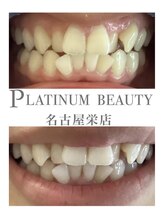 プラチナムビューティー 名古屋栄本店(PLATINUM BEAUTY)/お客様Before After