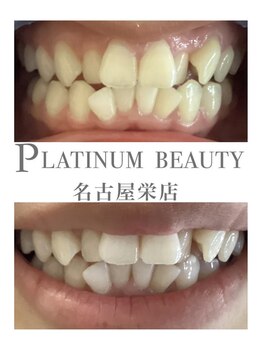 プラチナムビューティー 名古屋栄本店(PLATINUM BEAUTY)/お客様Before After
