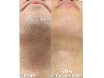 モアビューティ(More Beauty)の写真