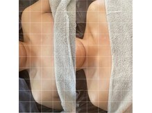 トリムハンド1回のビフォーアフターです。