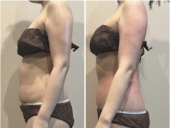 マイティー整骨院 ココア(CoCoa)/セルクラ