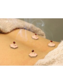 鍼灸施術を受けたい