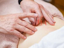 たけうち鍼灸接骨院の雰囲気（国家資格保持者による鍼灸×整体の施術も行います。）