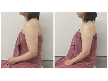 ブリランテ(Brillante)/