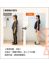 ただき接骨院 整体院 高崎本院/お悩み：骨盤開き、ぽっこりお腹