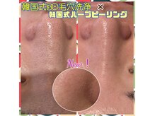 ピエナ(Piena)の雰囲気(韓国式フェイシャルセットメニューで毛穴集中クリアケアを♪)