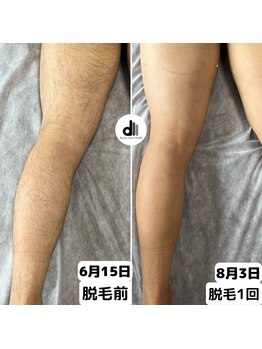 ビューティーサロン マル(Beauty Salon MARU)/