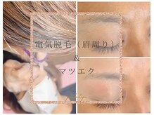 セットでお得♪Eyeメニュー＋眉周り脱毛