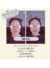 アンジュ/Before&After