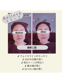 アンジュ/Before&After