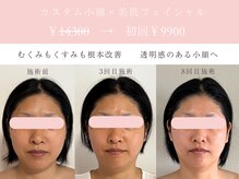 シンナリ(Shinnari)