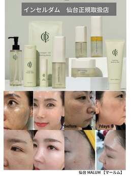 マールム(MALUM)/インセルダム　体験