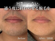 ダイヤ 名古屋中川区店(Daiya)の雰囲気（どんな青ヒゲも見極めと当て方で平均3回でここまで変わる。 ）