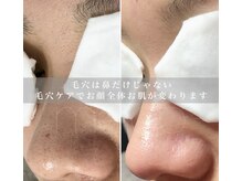 ミラボ(melab)の雰囲気(リピート率90%超え!毛穴ケアで即効お悩み改善♪/毛穴/毛穴ケア)
