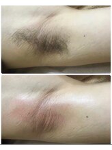 ジョアアンジェ 京橋店(joie ange)/ワキも綺麗に！