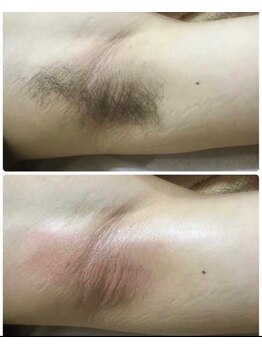 ジョアアンジェ 京橋店(joie ange)/ワキも綺麗に！