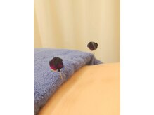 アガペー鍼灸