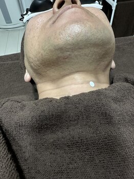 ビーンズ(BEANS)/