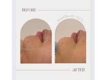 アリー(ALLY)/艶肌wax