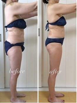 バニスティ 酒田店/あしながも期待できる