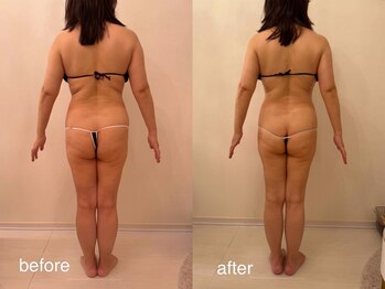 クロレ 浦和店(CLORE)/50代のお客様/9回施術