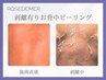 【剥離ダウンタイム有】ローズドメーラお背中ピーリング(ホ-ムケア付)¥33000~