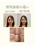 【夏の美肌回復ケア】40代からの韓国肌管理フェイシャル¥3980