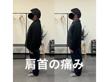 カワル整体 長嶺院/ストレートネック